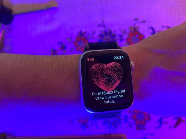 apple-watch-icin-uzun-zamandir-beklenen-guncelleme-geldi